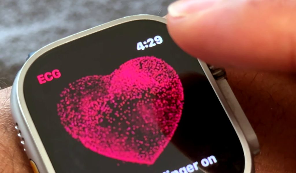 Apple-Watch-hipertensiune-tehnologie-masurare.jpg