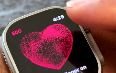 Apple-Watch-hipertensiune-tehnologie-masurare.jpg