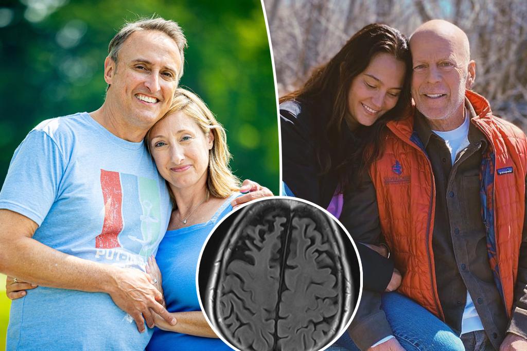 Bruce Willis and wife help couple facing young dementia diagnosis