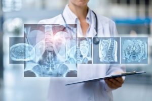 Medici din Timișoara vor crea un registru pentru pacienții cu astm bronșic sever, oferindu-le tratamente adaptate nevoilor individuale