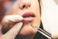 botox-lips-buze-acid-hialuronic-interventie-chirurgicala-operatie-estetica.jpg