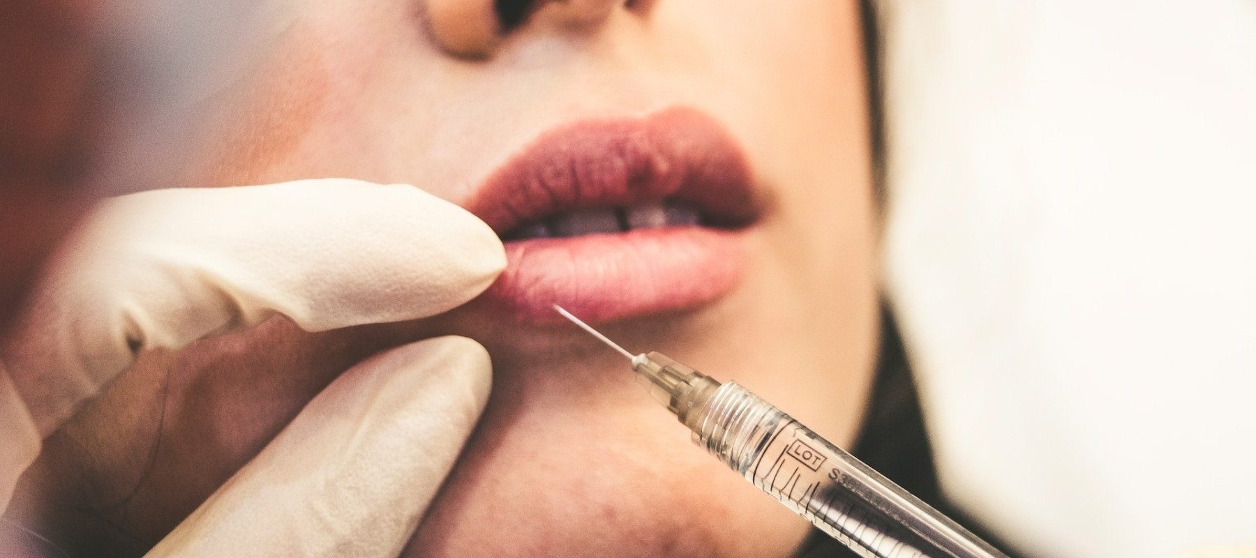 botox-lips-buze-acid-hialuronic-interventie-chirurgicala-operatie-estetica.jpg