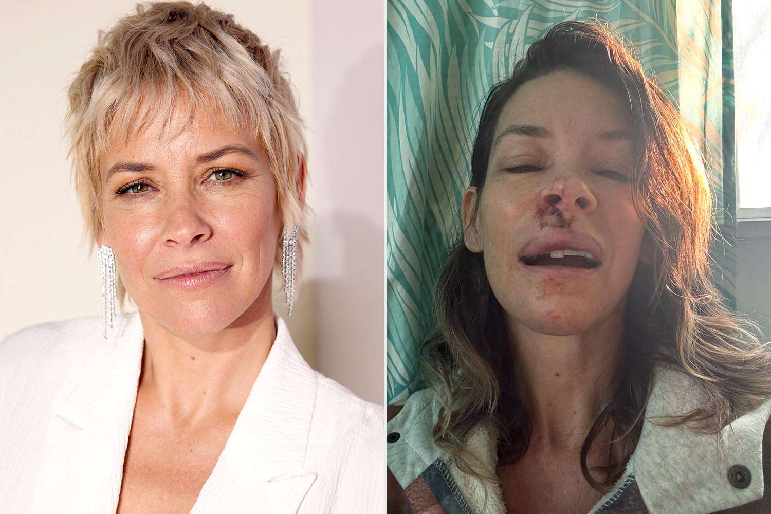Evangeline Lilly anunță că suferă de daune cerebrale Actrița Evangeline Lilly, cunoscută pentru rolul său din serialul „Lost” și din franciza „Ant-Man”, a dezvăluit recent o veste alarmantă: teste recente au arătat că aproape toate regiunile din creierul său funcționează la capacitate redusă