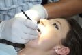 teeth-cleaning-1514692_1280.jpg