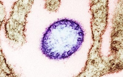 virus-Nipah.jpg