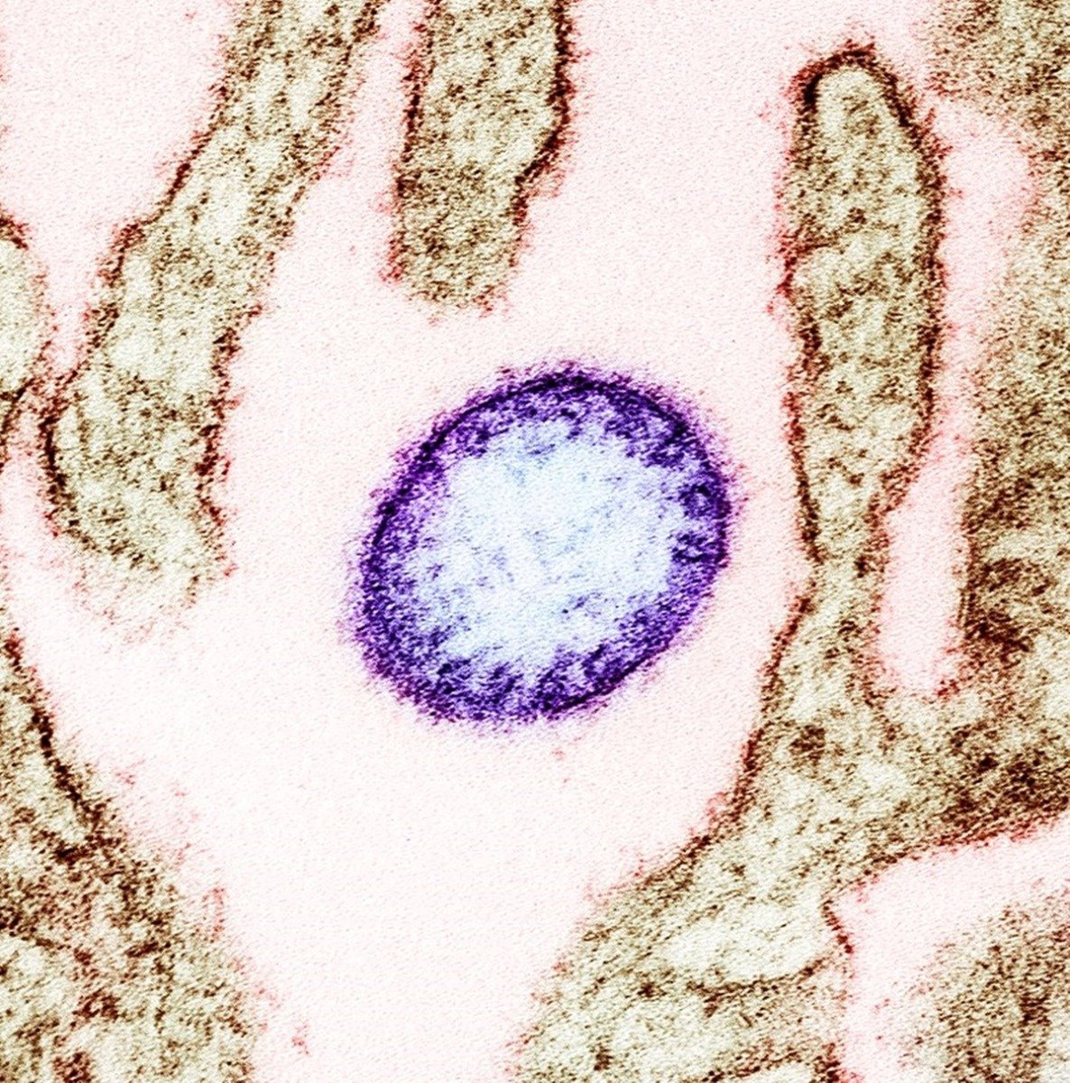 Organizația Mondială a Sănătății minimalizează riscul de răspândire a virusului Nipah după confirmarea a două cazuri în India Riscul de răspândire a virusului Nipah, o forță mortală din spectrul virusurilor emergente, a fost considerat redus de către Organizația Mondială a Sănătății (OMS) în contextul recentelor cazuri confirmate în India