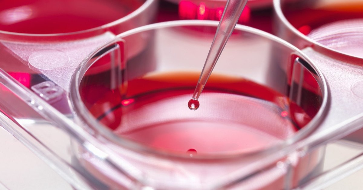 Opțiuni:

Cercetare: Mecanism identificat pentru stoparea leucemiei agresive. (67 caractere)
Știință: Posibilă soluție pentru leucemia agresivă, descoperită. (63 caractere)
Leucemie agresivă: Mecanism nou, posibil blocant, identificat. (66 caractere)
Atenție! Studiu: Mecanism nou vizează leucemia agresivă. (62 caractere)