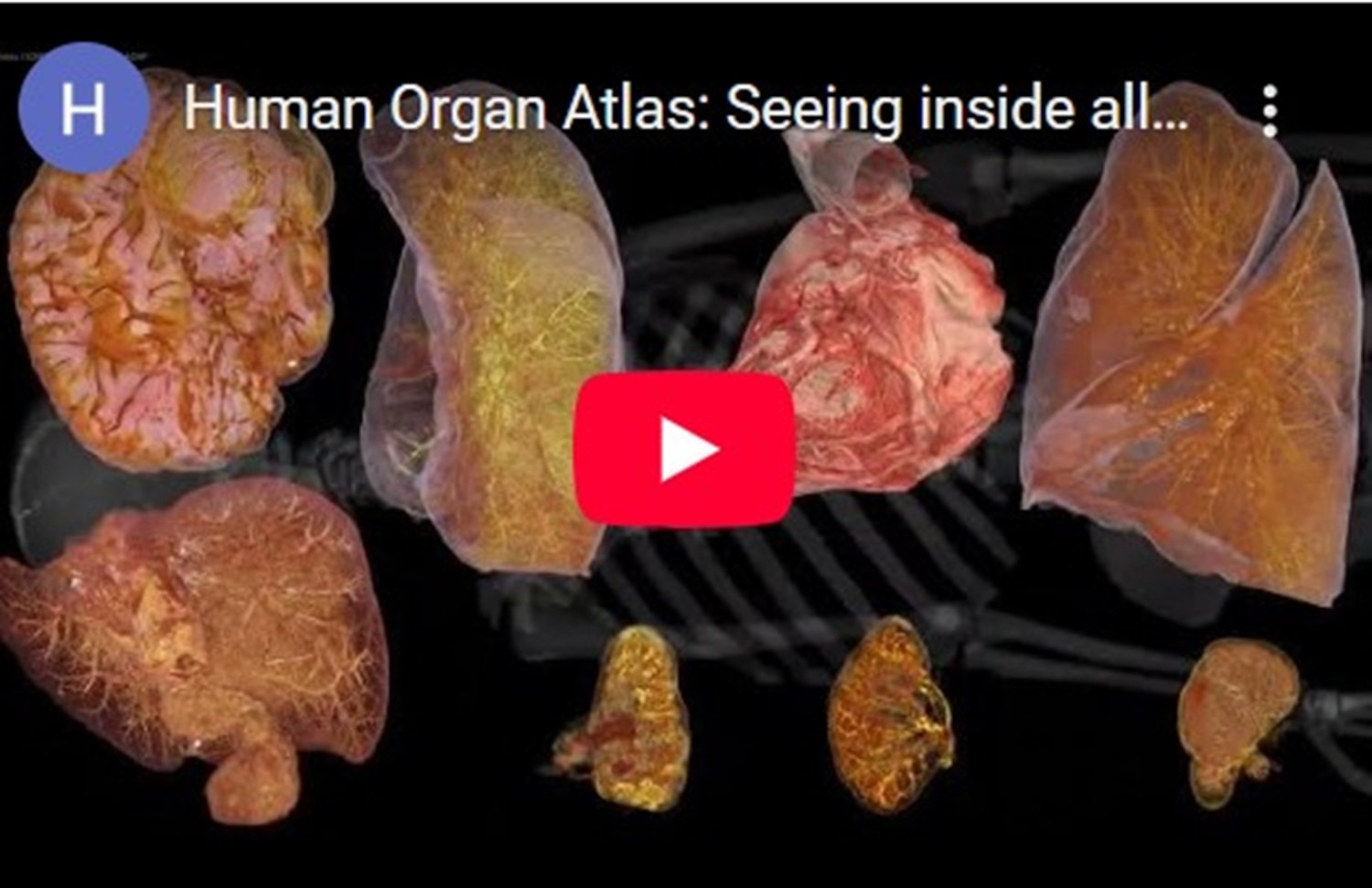 Un atlas detaliat al corpului uman, accesibil online, revoluționează studiul anatomiei Un proiect ambițios, dezvoltat pe parcursul a șase ani de un consorțiu format din nouă institute de cercetare din Europa și Statele Unite, a fost publicat în revista Science Advances
