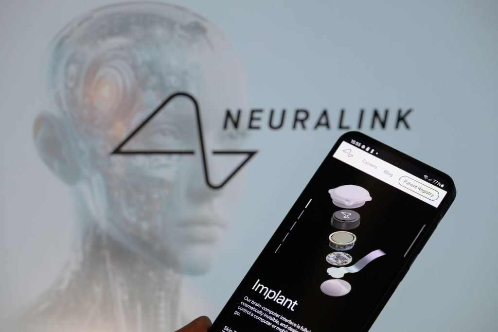 China autorizează primul implant cerebral comercial, o lovitură pentru startup-urile locale Shanghai, China – Autoritățile chineze au aprobat comercializarea primului implant cerebral dezvoltat de o companie locală, Neuracle Technology, un pas important pentru piața tehnologiilor de interfață creier-computer (BCI)