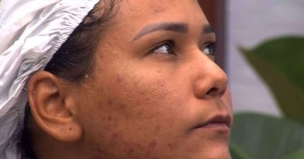 Participarea lui Chaiany Andrade la „Big Brother Brasil 26” a stârnit dezbateri importante despre acnee și îngrijirea pielii, un subiect cu care se confruntă mulți oameni