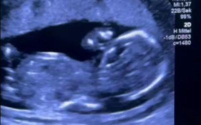 Gravidă, umilită la Filantropia București: Pleacă la tratament în Germania