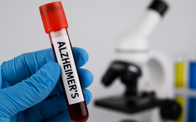 Un simplu test de sânge ar putea revoluționa depistarea demenței Un test de sânge, ușor de realizat, ar putea identifica riscul de demență cu zeci de ani înainte ca primele simptome să apară