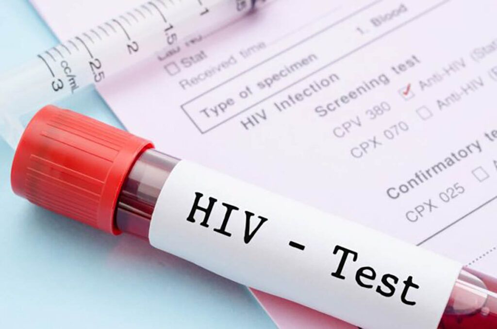 Bărbat vindecat de HIV, fără tratament! Un caz medical rar uimește lumea
