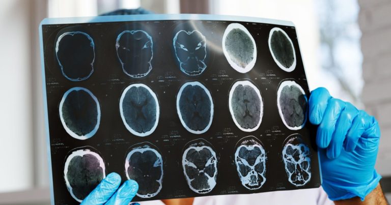 Scandal în sănătate: Pacienții cer intervenție după scăderea drastică a investigațiilor