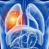 Avertisment după COVID-19: Ce efecte are virusul asupra plămânilor?