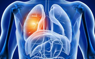 Avertisment după COVID-19: Ce efecte are virusul asupra plămânilor?