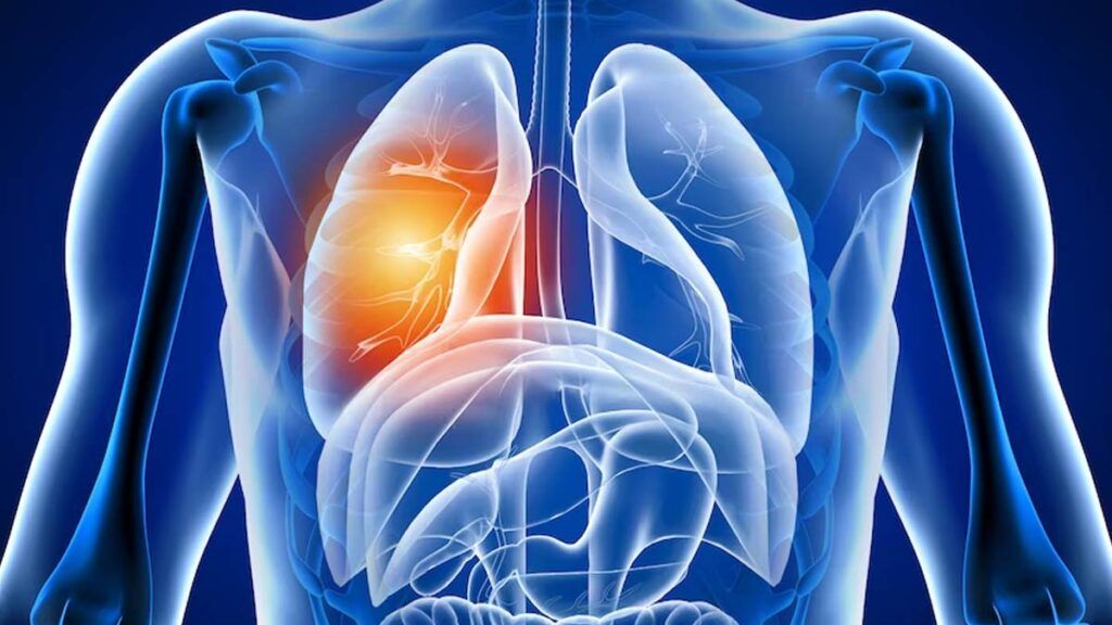 Avertisment după COVID-19: Ce efecte are virusul asupra plămânilor?