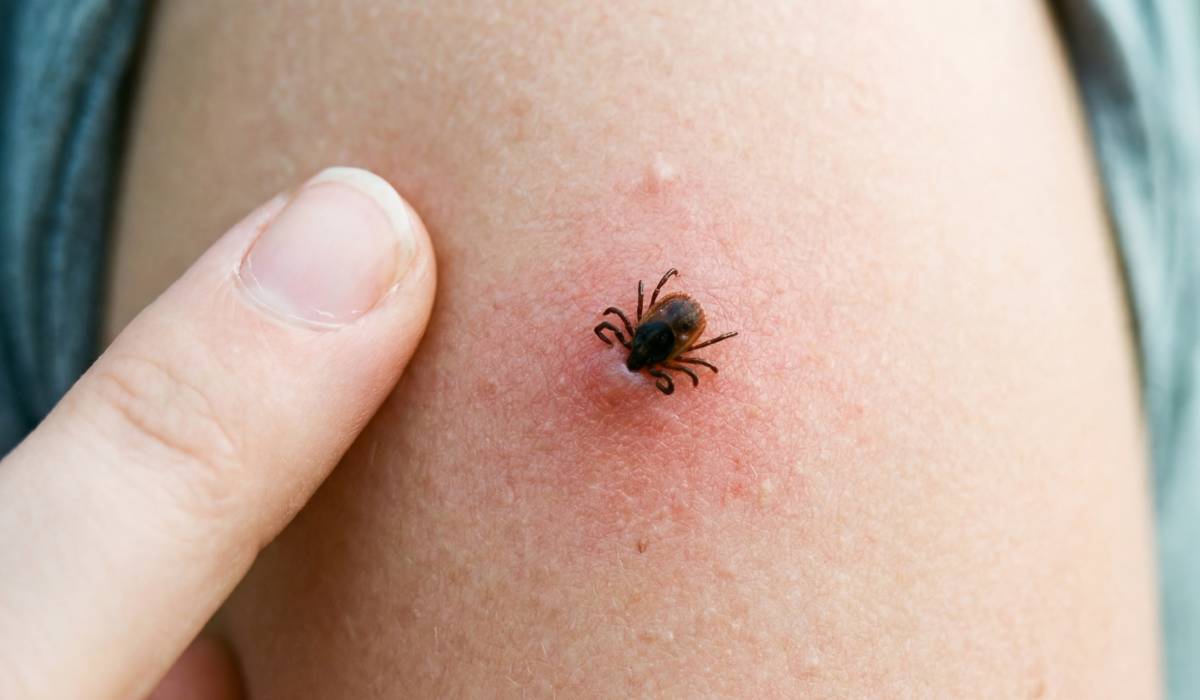 Cum să eviți țânțarii, căpușele și păianjenii: Sfaturi utile