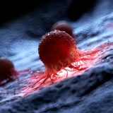 AI detectează cancerul de piele cu ani înainte: Studiul ȘOC