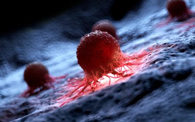 AI detectează cancerul de piele cu ani înainte: Studiul ȘOC