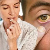 Aspirina zilnică, pericol ascuns? Avertismentul unui cardiolog pentru români