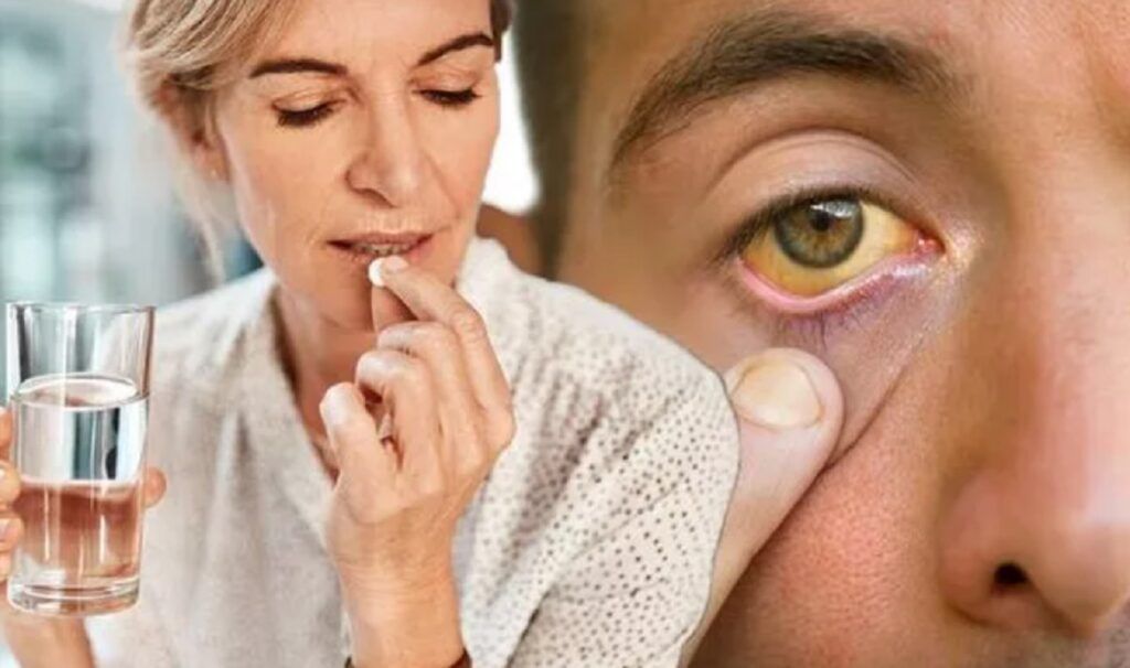 Aspirina zilnică, pericol ascuns? Avertismentul unui cardiolog pentru români