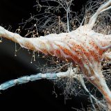 Studiu-șoc: Inflamația intestinală, posibilă cauză a sclerozei multiple