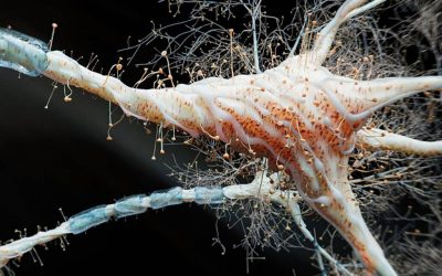 Studiu-șoc: Inflamația intestinală, posibilă cauză a sclerozei multiple