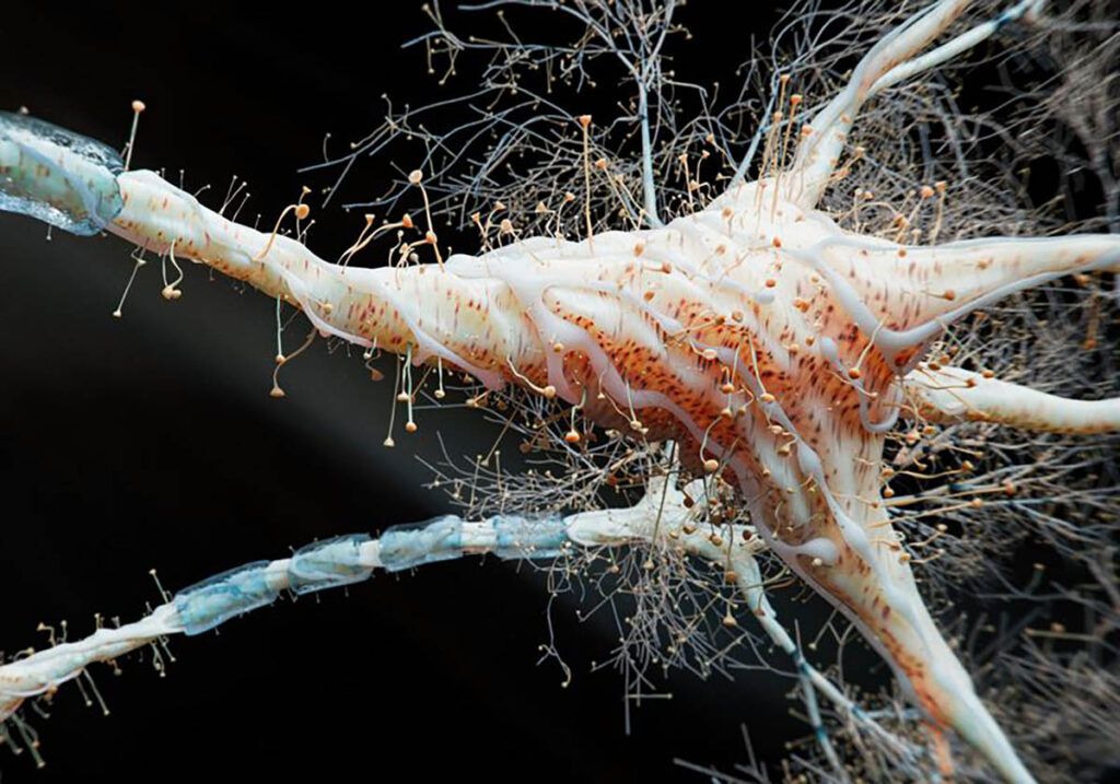 Studiu-șoc: Inflamația intestinală, posibilă cauză a sclerozei multiple