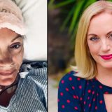 Cancer intestinal la 44 de ani: Medicii, în alertă. Ce suspectează?