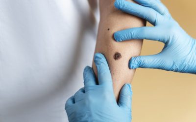 O aluniță fatală: O femeie a murit după o intervenție șocantă