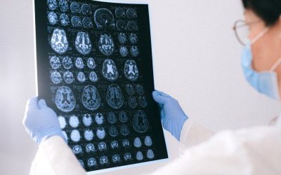 Primul semn al declinului cognitiv, ignorat adesea: Ce spune un neurolog
