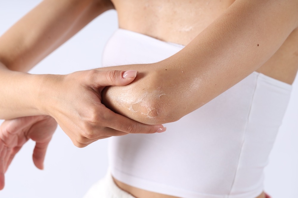 Piele uscată pe brațe și picioare? 5 obiceiuri care-ți fac rău