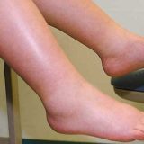 Leguma-minune: Scapă de retenția de apă și revitalizează circulația!