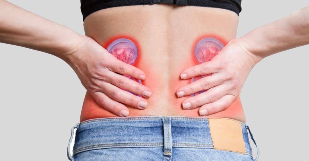 Apa, insuficientă: Ce au descoperit cercetătorii despre pietrele la rinichi