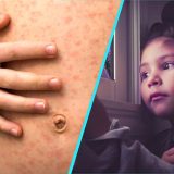 Rujeolă, gripă, vaccinare: Doctorița Sandra Alexiu trage semnalul de alarmă în România