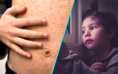 Rujeolă, gripă, vaccinare: Doctorița Sandra Alexiu trage semnalul de alarmă în România