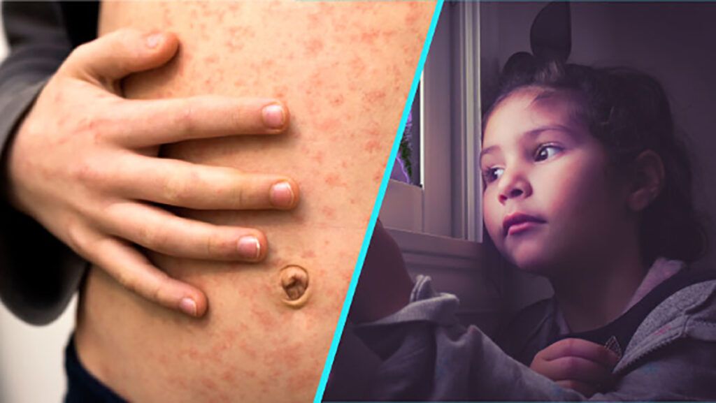 Rujeolă, gripă, vaccinare: Doctorița Sandra Alexiu trage semnalul de alarmă în România