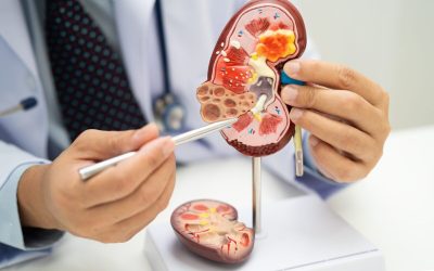 Acid uric vs. Creatinină: Ce indică analizele despre rinichi