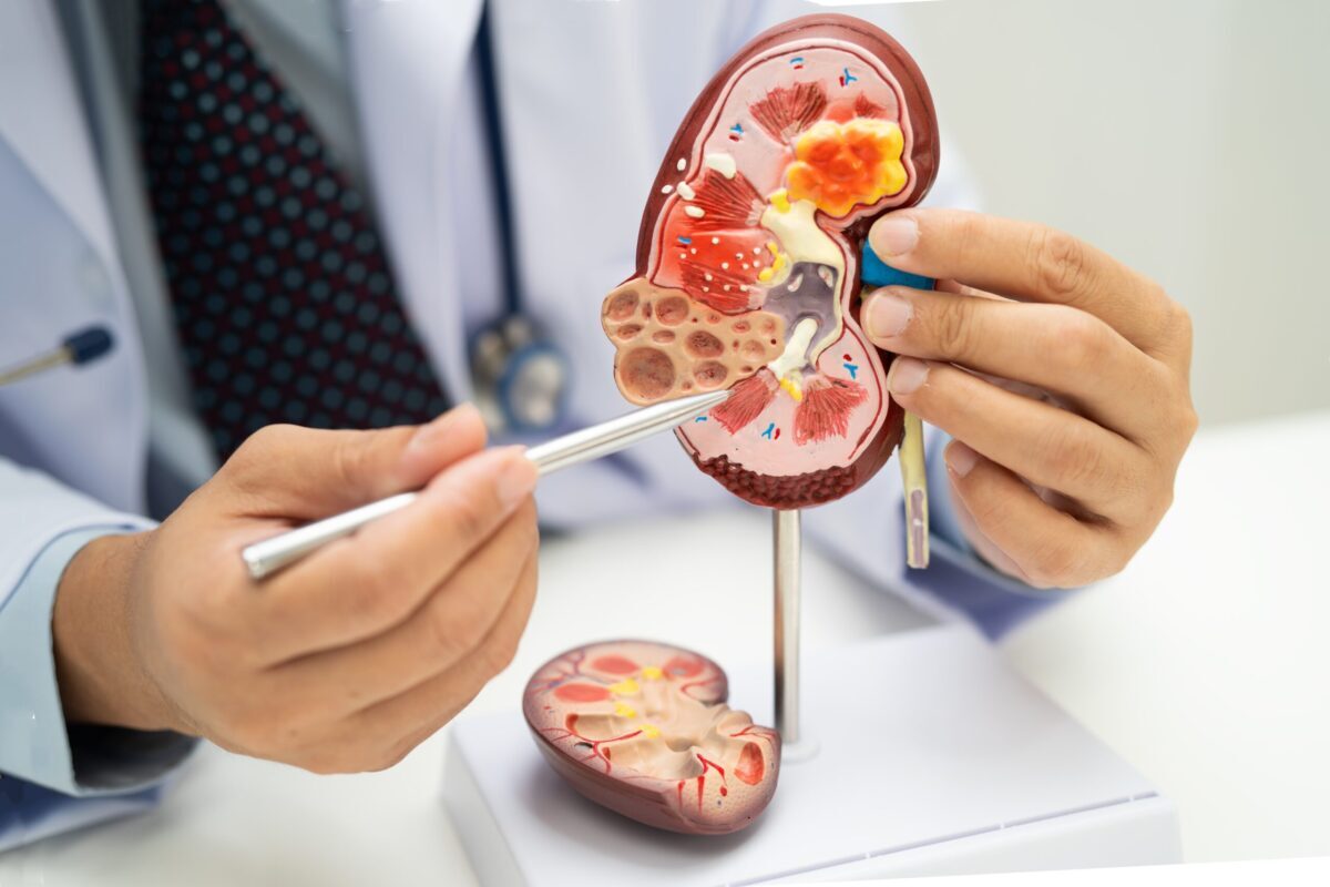 Acid uric vs. Creatinină: Ce indică analizele despre rinichi
