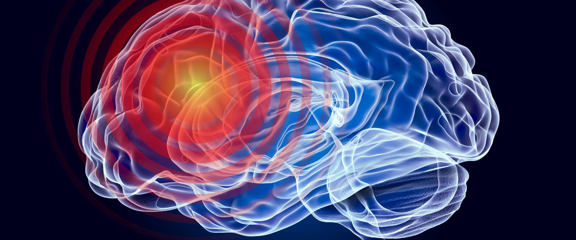 O boală neurologică, necunoscută până acum, face ravagii în lume