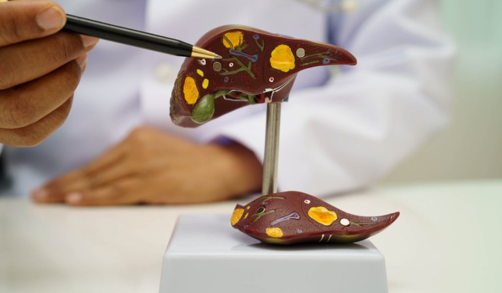 Boala ficatului gras: Atentie la acest „simptom” vital!