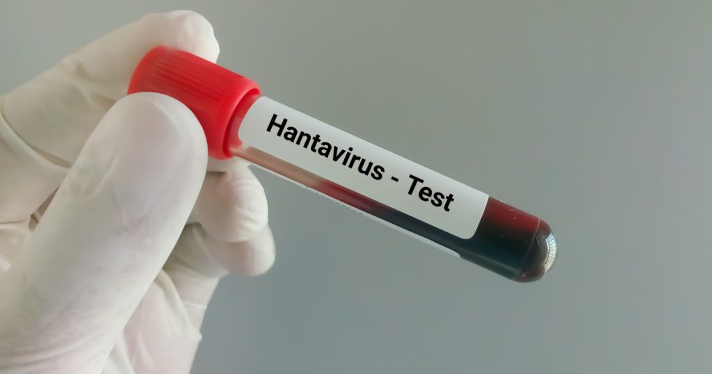 Hantavirus: Pompier de la ISU Caraș-Severin, suspect de infecție după o călătorie în Serbia