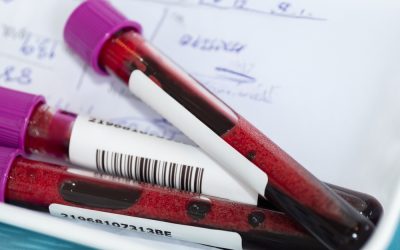 Analizele care arată dacă diabetul a afectat rinichii: Ce trebuie să știi