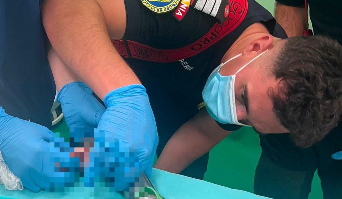 Pompierii salvează un copil blocat într-o mașină de tocat
