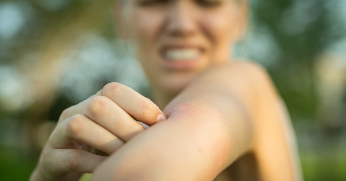 Țânțari cu malaria, doi morți pe aeroport din Germania