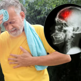 Amețeală? Poate fi „mini-AVC”! Simptome de urgență medicală