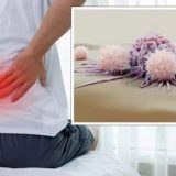Cancerul „tăcut”: 5 semne neașteptate te trimit la medic