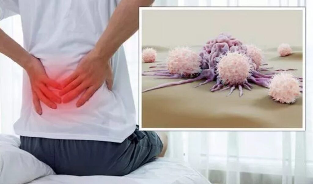 Cancerul „tăcut”: 5 semne neașteptate te trimit la medic