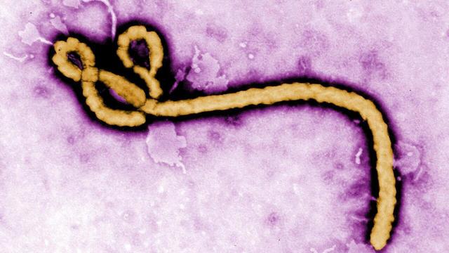 Ebola s-a mutat în RD Congo: Virusul a suferit mutații